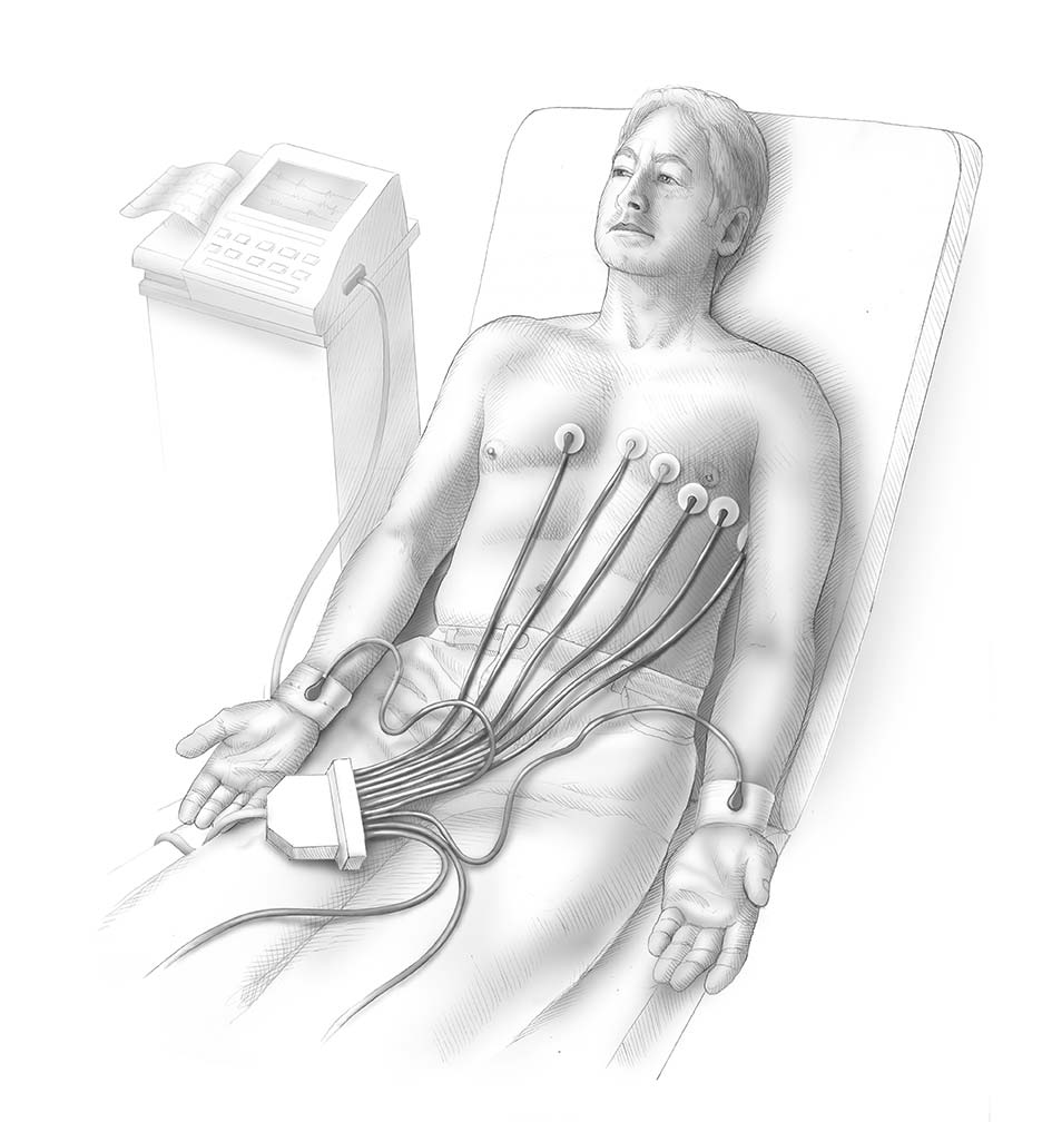 Illustrasjon av person som tar EKG-undersøkelse