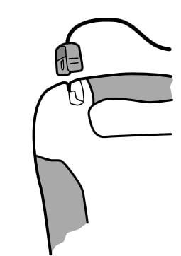 bilde elektrodekontakt p&aring; defibtech AED