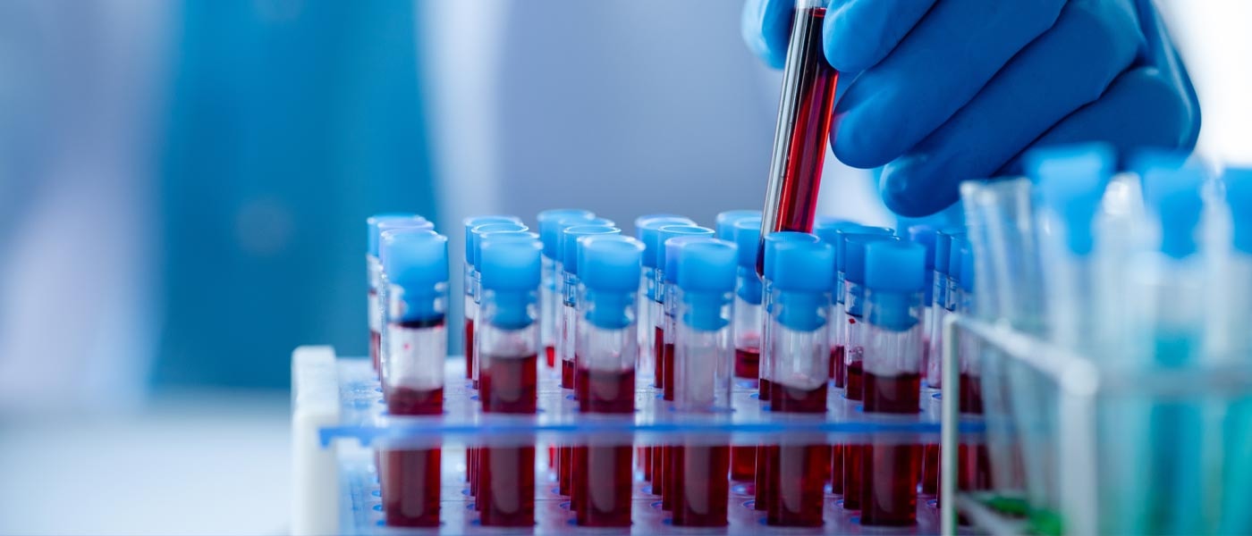 Blodprøver