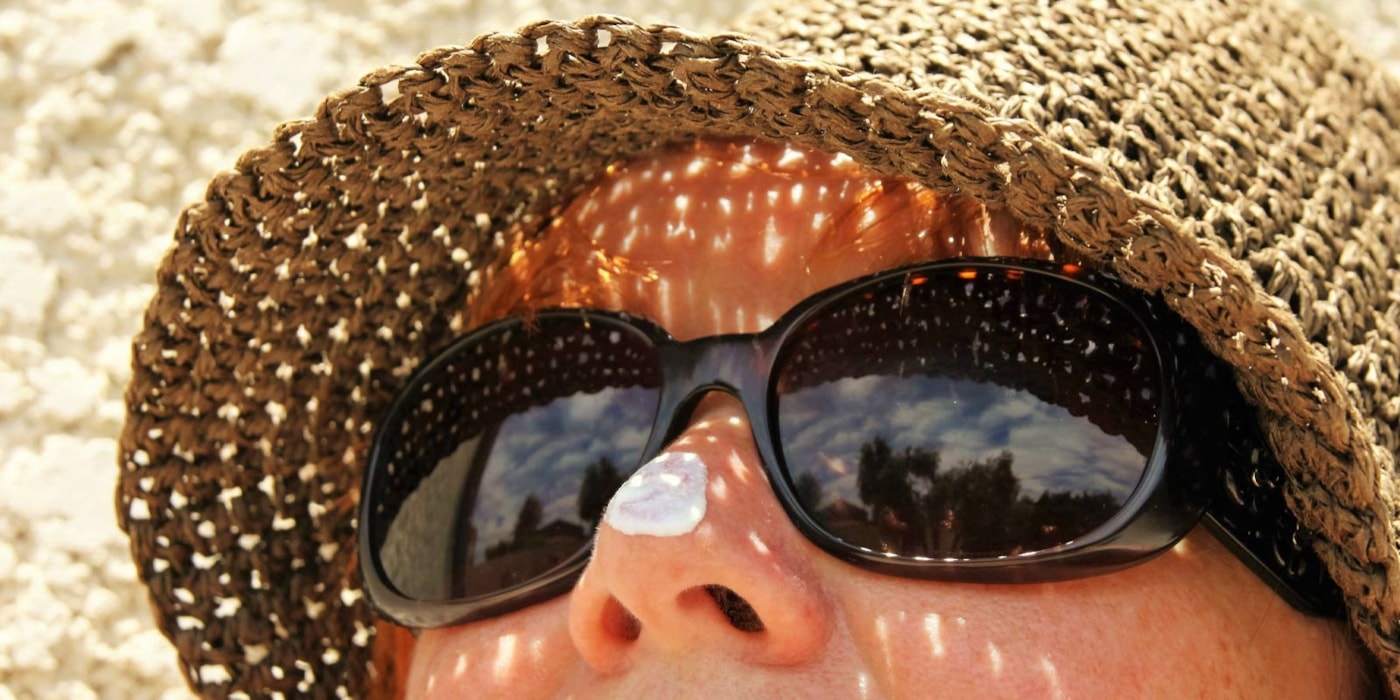 Bilde av dame med solhatt, solbriller og solkrem på nesen